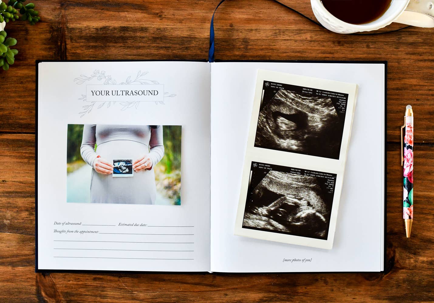 Duncan & Stone Paper Co. - Dear Baby: A Pregnancy Prayer Journal & Memory Book for Moms